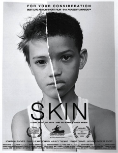 正に“いま観るべき映画”！ 人種問題を子供の視点から描く『SKIN 短編』が期間限定で無料配信!!