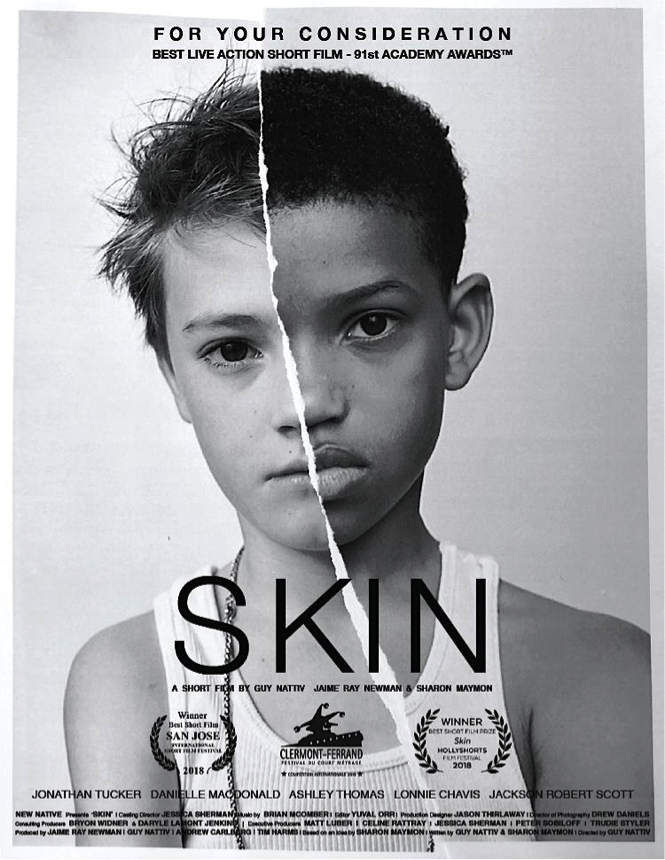 正に“いま観るべき映画”！ 人種問題を子供の視点から描く『SKIN 短編』が期間限定で無料配信!!